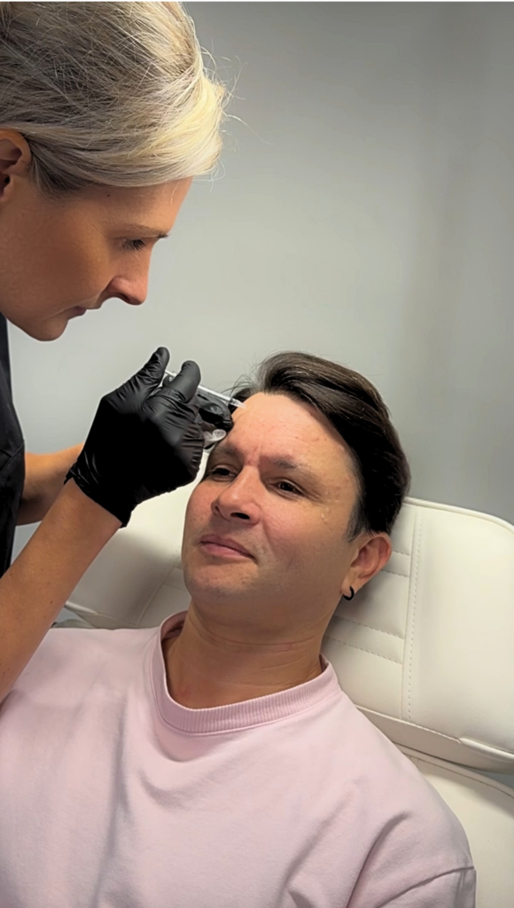 Botuline toxine behandeling bij man op het voorhoofd uitgevoerd door cosmetisch arts